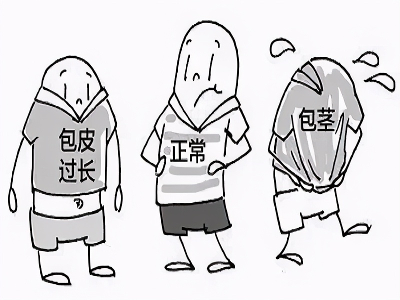 割包皮能当天做当天走吗,割包皮当天去医院当天就能割吗