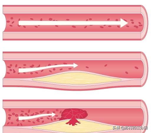 年轻人经常抽筋吃什么好,夏天腿抽筋吃什么改善