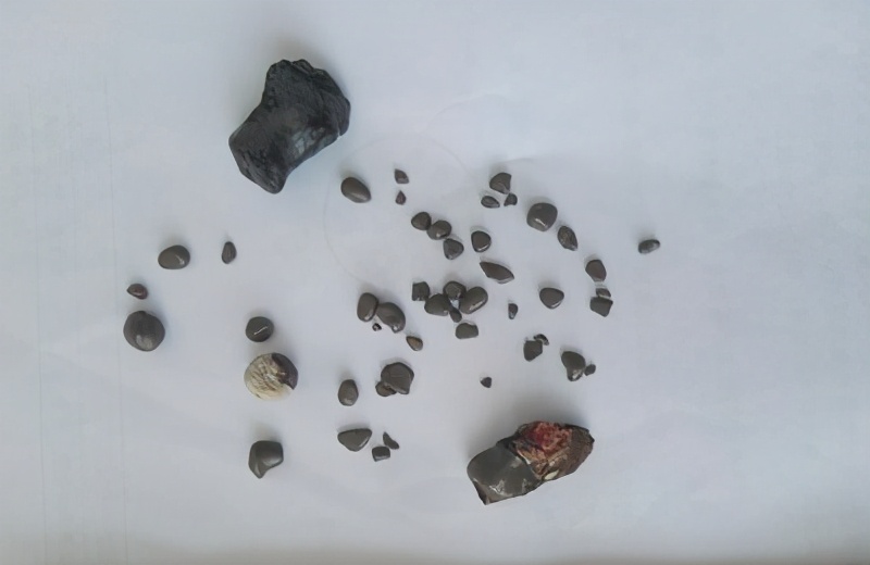 尿尿泡沫多是湿热吗,尿尿泡沫多尿臭是什么原因