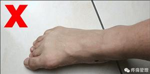 专门改善扁平足的运动,站着改善小腿外翻