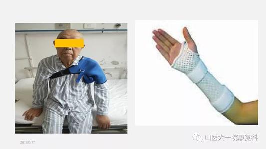 偏瘫患者发生肩痛采取什么措施,偏瘫肩手肿