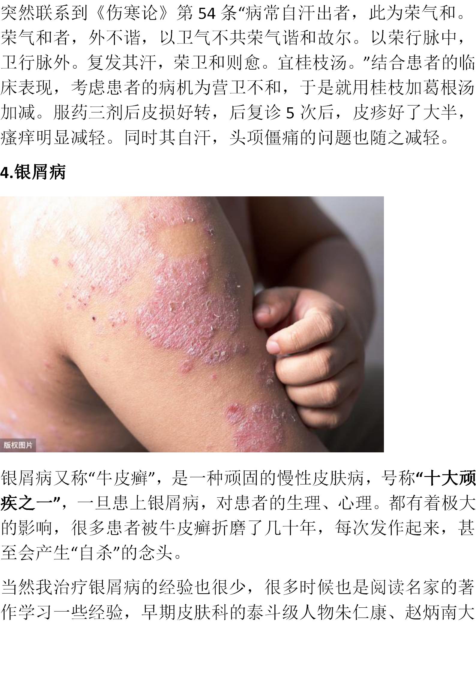 倪师治皮肤病的经方有几个,寒湿皮肤病倪海厦用什么经方