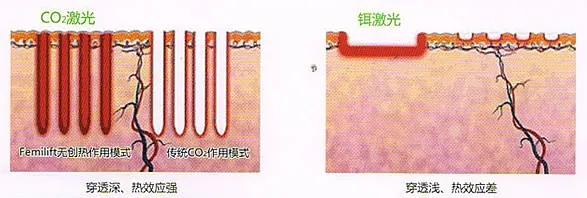 这项抗衰老技术，让美丽由内而外！女性朋友值得体验……