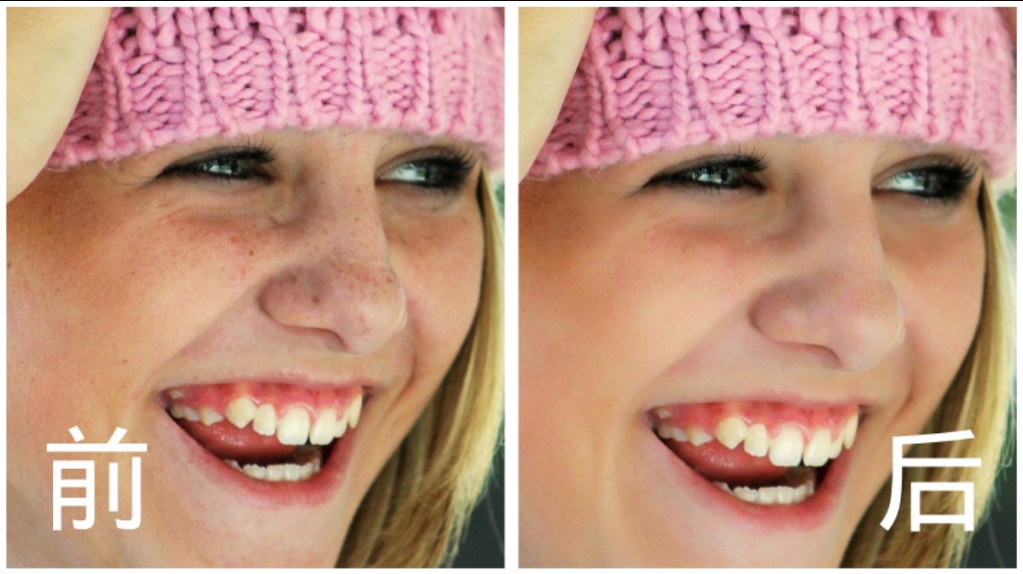 消除snapseed蒙版,去除人物脸部瑕疵教程