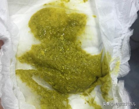 宝宝拉绿便不怎么长肉喝什么奶粉,宝宝拉绿色便便是妈妈吃凉的了吗