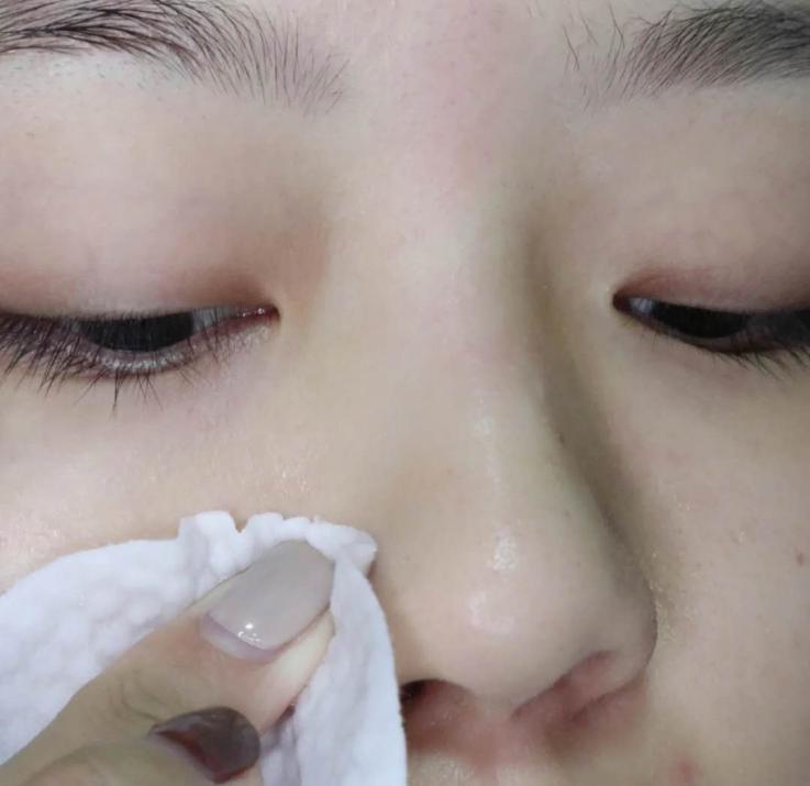 卸妆油对付黑头,家里卸妆产品用完了能用什么卸妆