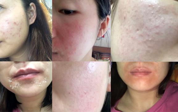 德国嫩芙妊娠纹修护霜,德国嫩芙孕妇洗面奶