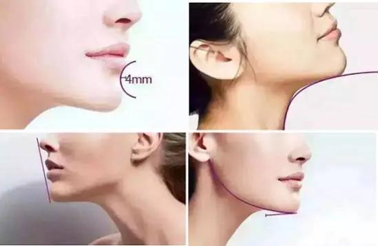 下巴短不尖怎么改善小窍门,下巴短没有后缩怎么改善