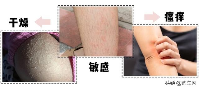 洗澡时搓出泥状物好不好,搓泥搓出来白色的是什么