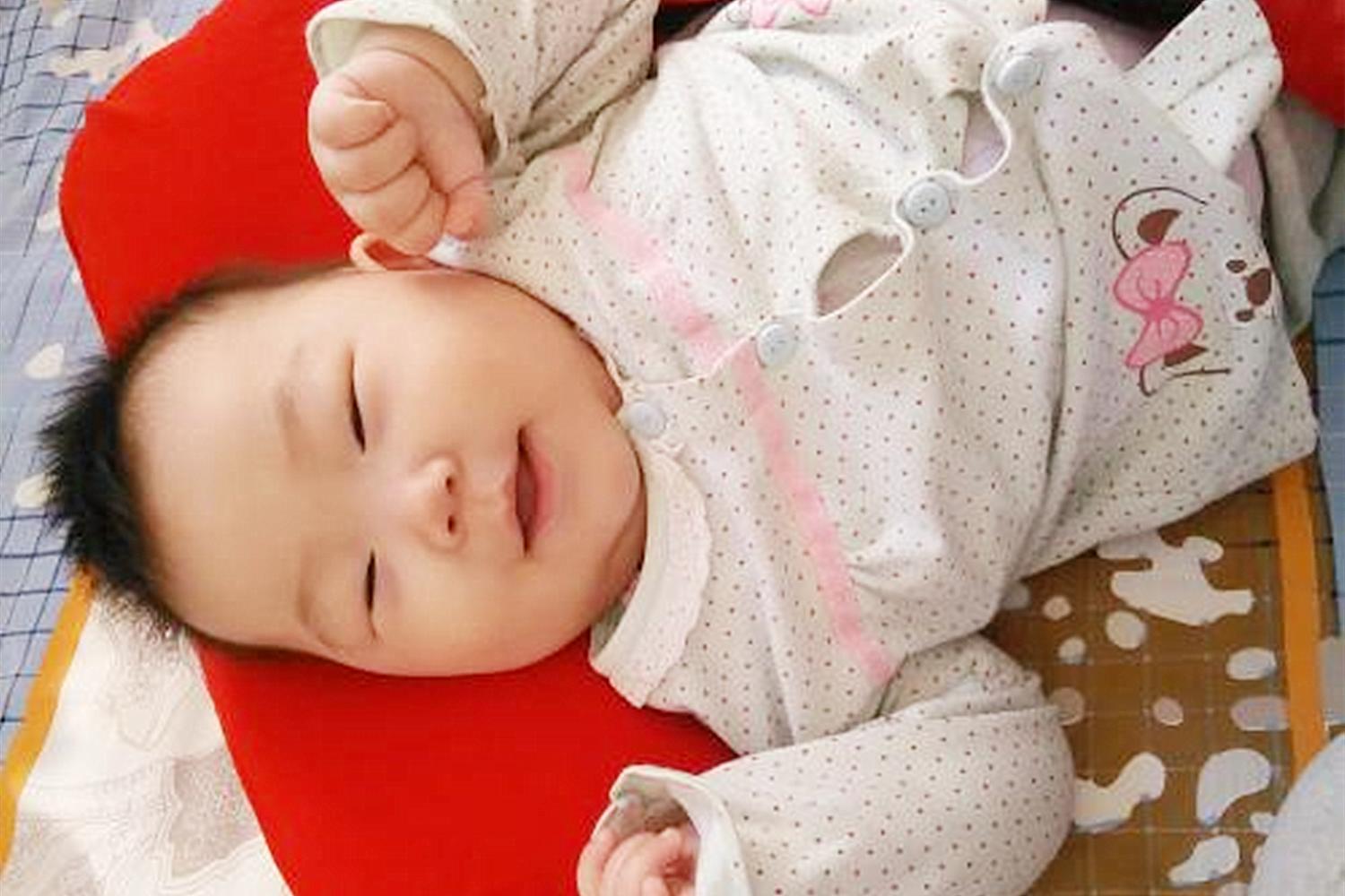 宝宝淹脖子妈妈饮食应该注意什么,宝宝淹脖子怎么护理