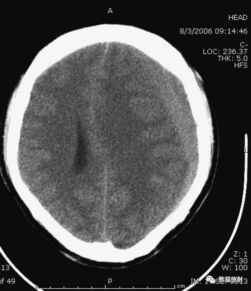 值夜班需要注意什么身体健康,值夜班的十大危害