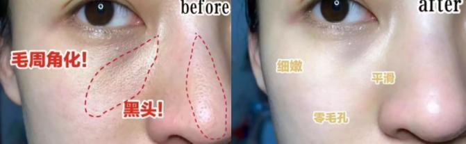 张韶涵澳洲玲珑面膜,张韶涵护肤敏感肌