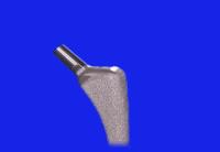 髋关节置换如何抗感染,骨科髋关节置换术后注意事项