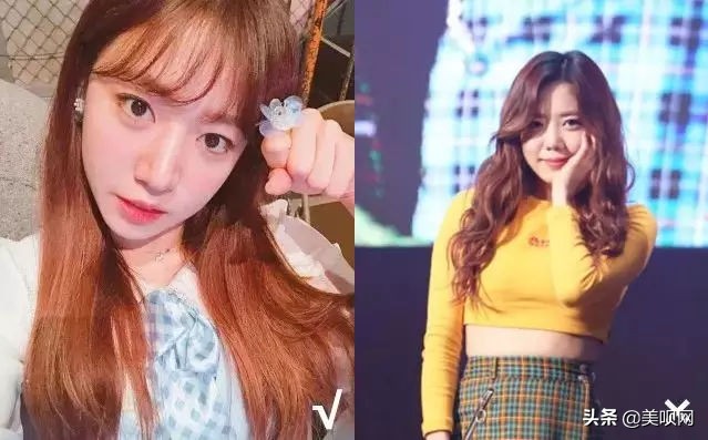 明星都在用的缩小鼻翼神器,明星鼻子做鼻翼缩小外切