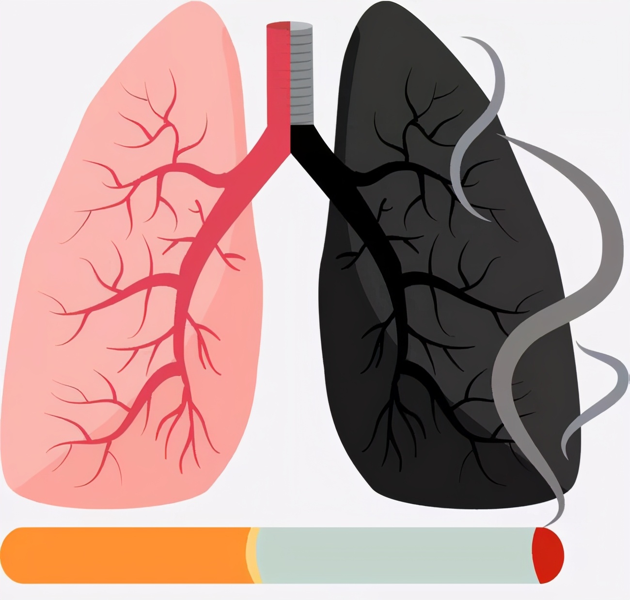 淄博中心医院可以做螺旋ct吗,低剂量螺旋ct能查出多少厘米肺癌