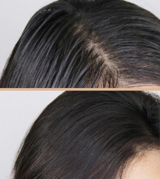 拉芳控油洗发水掉发,拉芳洗发水洗了掉发严重