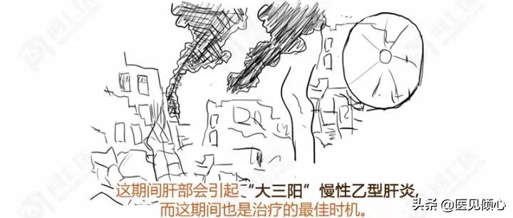 郑教授谈乙肝治愈率,医哥说健康