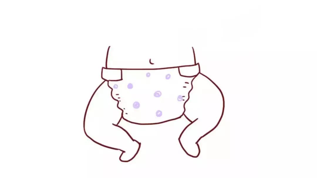 宝宝尿不湿换很勤还是被淹了,宝宝尿不湿尿了就换