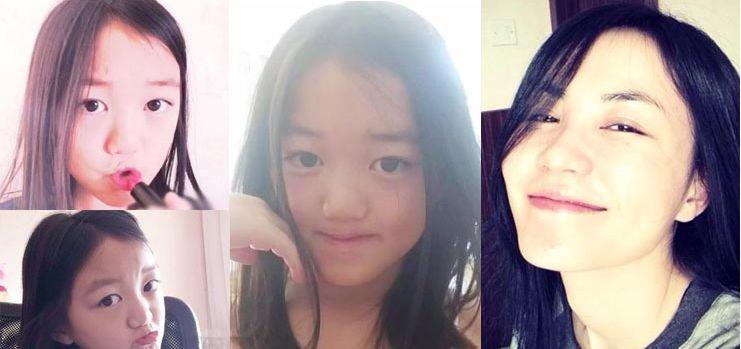 李嫣手术前后,李嫣再次手术兔唇吗