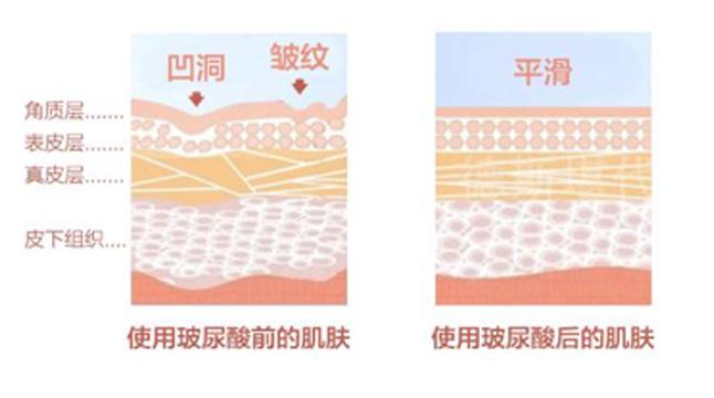 同样商品为什么女人喜欢买贵的,同样是购物为什么花钱更多