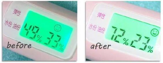 沙漠大干皮深层补水面膜推荐,适合沙漠大干皮用的保湿面膜