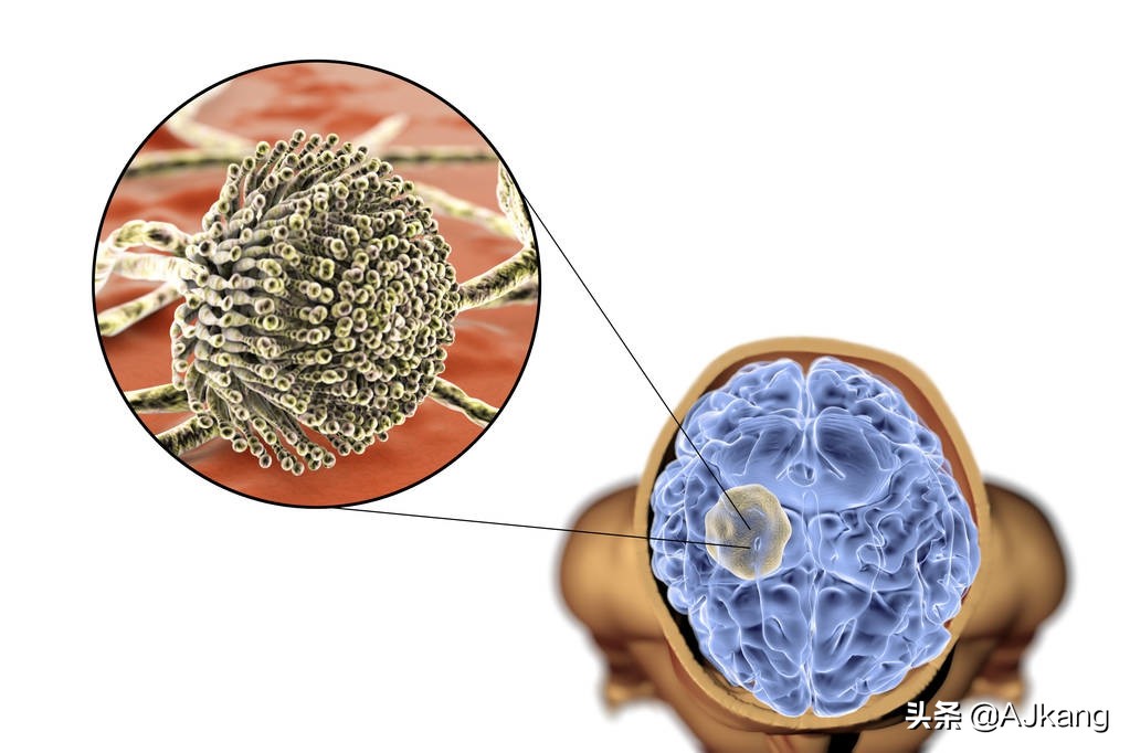 霉菌毒素:它们是什么?为什么对您有害?