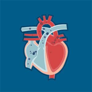 医生科普心衰能逆转吗,心衰患者一定要记住这些