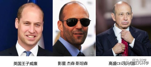 研究秃头30年后，日本老教授用复读机的方式解答脱发问题