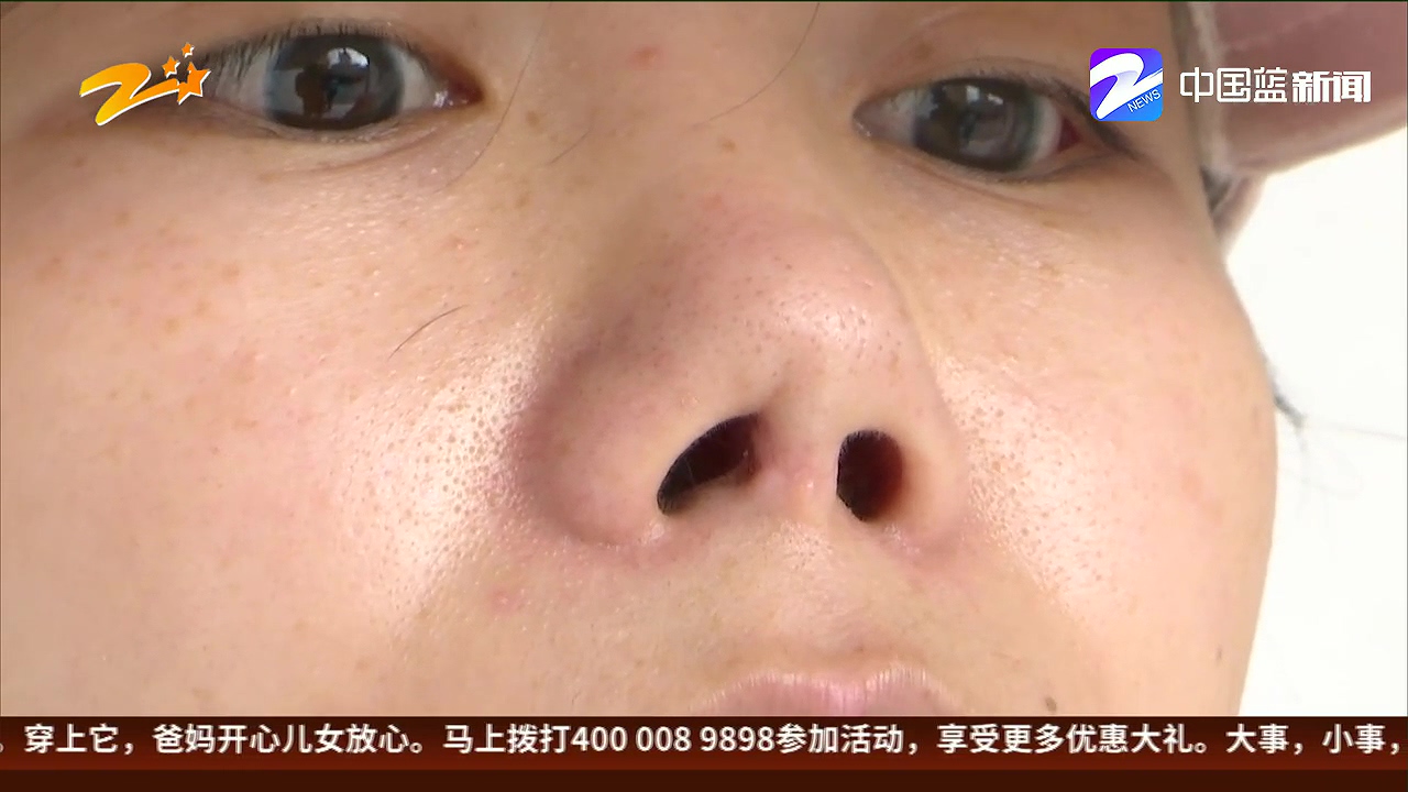 女子做鼻综合手术,莫名其妙鼻子流出黄色液体,这事到底怪医院还是怪她?