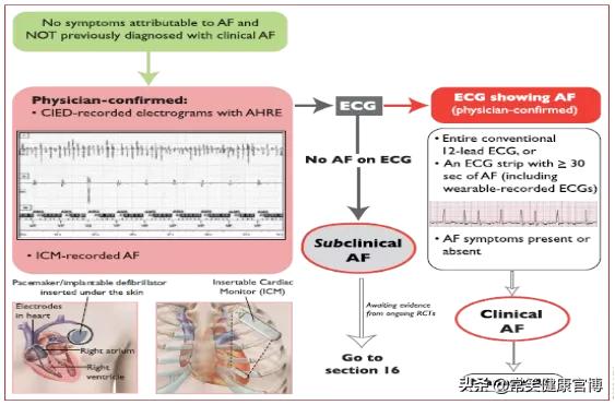 欧洲房颤指南,房颤最新指南解读
