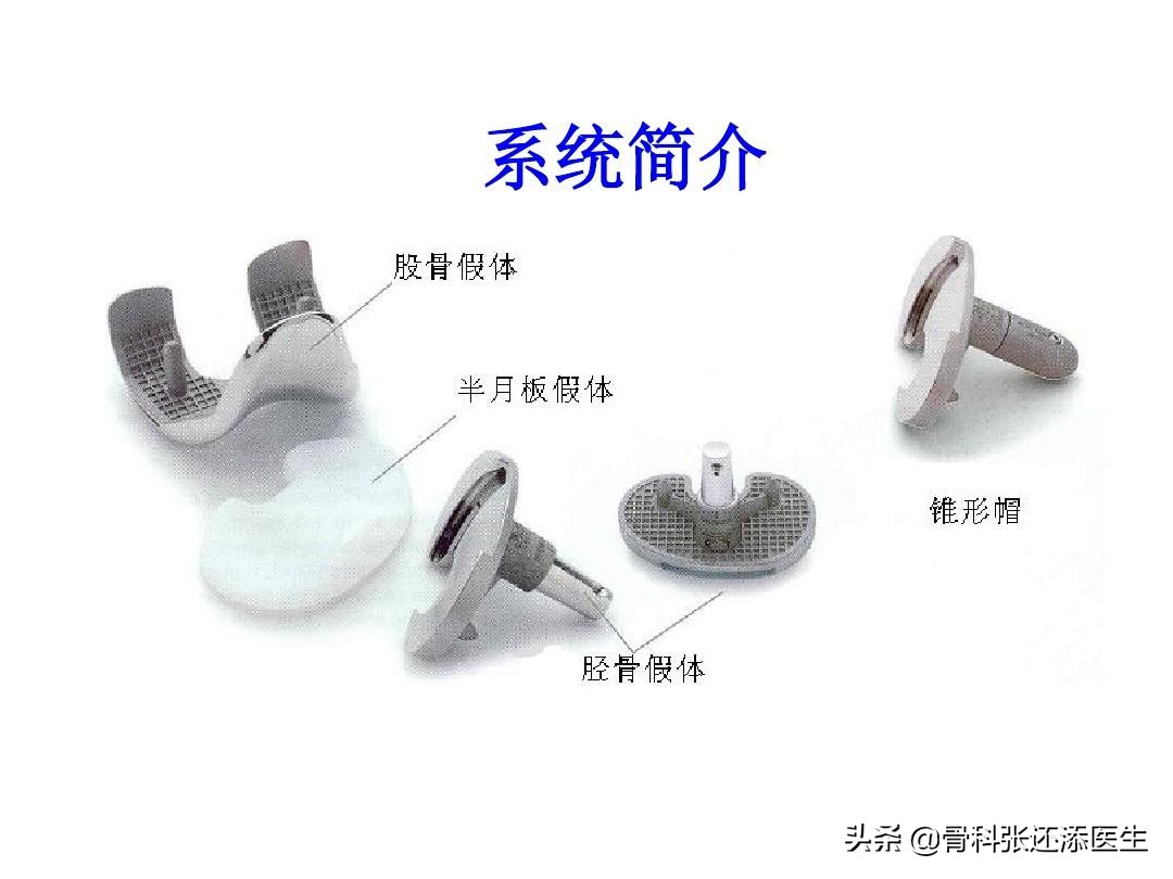 膝关节置换最坏后果,膝关节置换手术吓人