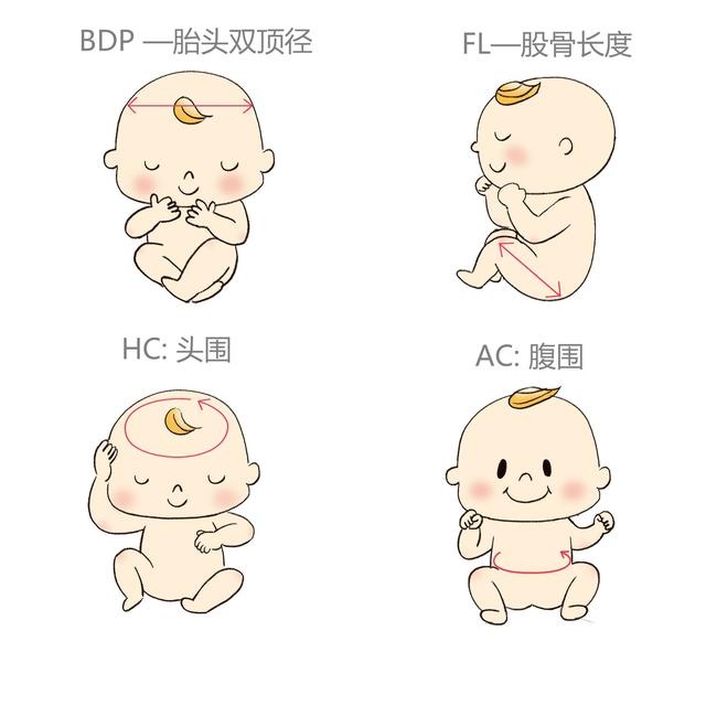 孕期四维超声结果参考,孕期四维检查结果怎么看