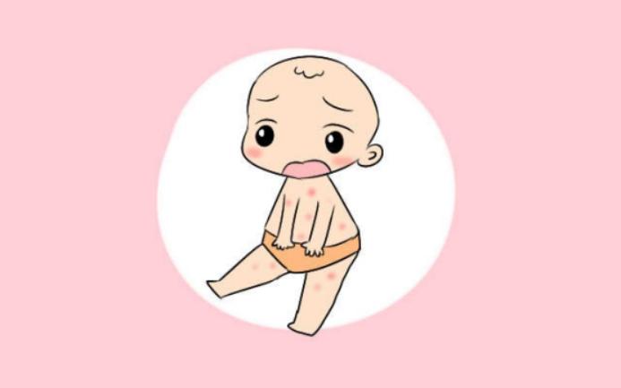 夏天宝宝湿疹的应对方法,夏天宝宝脸上长湿疹怎么办最有效