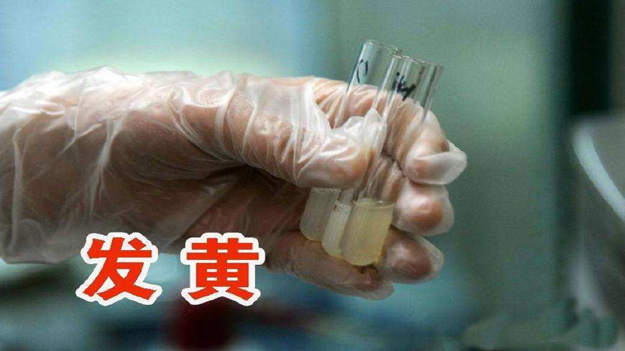 男的精子旺盛对怀孕有影响吗,男性精子有哪些问题影响怀孕