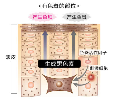 如何预防长斑和色素沉着,斑暗沉皮肤用什么护肤