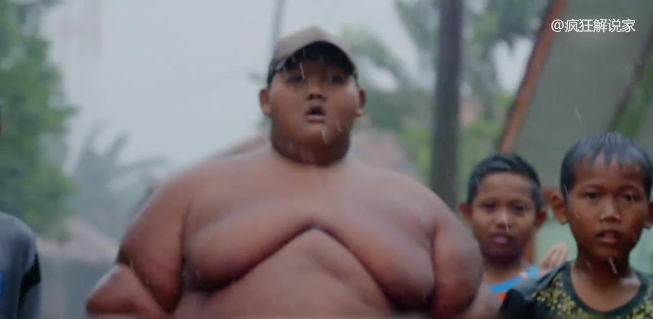 印尼最胖男孩减重200斤,印尼小胖墩