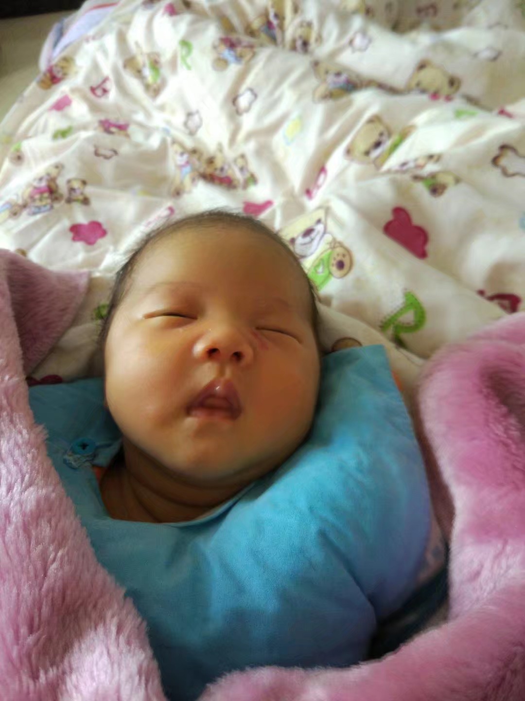 儿童血管瘤治疗成功经历,宝宝血管瘤康复过程视频