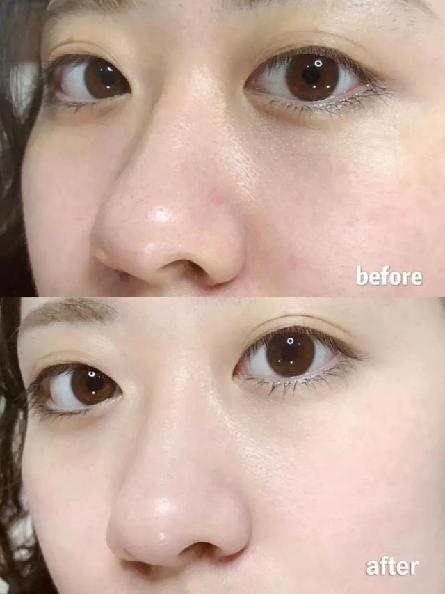 国货小蓝瓶都有哪些,国货小蓝瓶图片大全