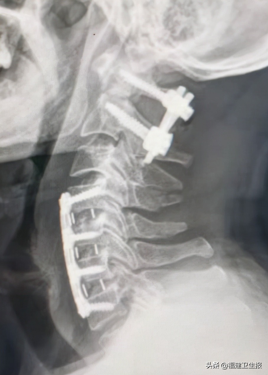 娉夊窞绗竴鍖婚櫌棰堟鎵嬫湳,娉夊窞鍖婚櫌棰堟寰垱