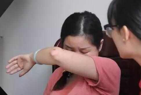 怎样防止孕期畸形,如果胎儿有畸形孕妇有什么表现