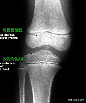 真正能让青春期孩子长高的方法,适合青春期的小孩快速长高的方法