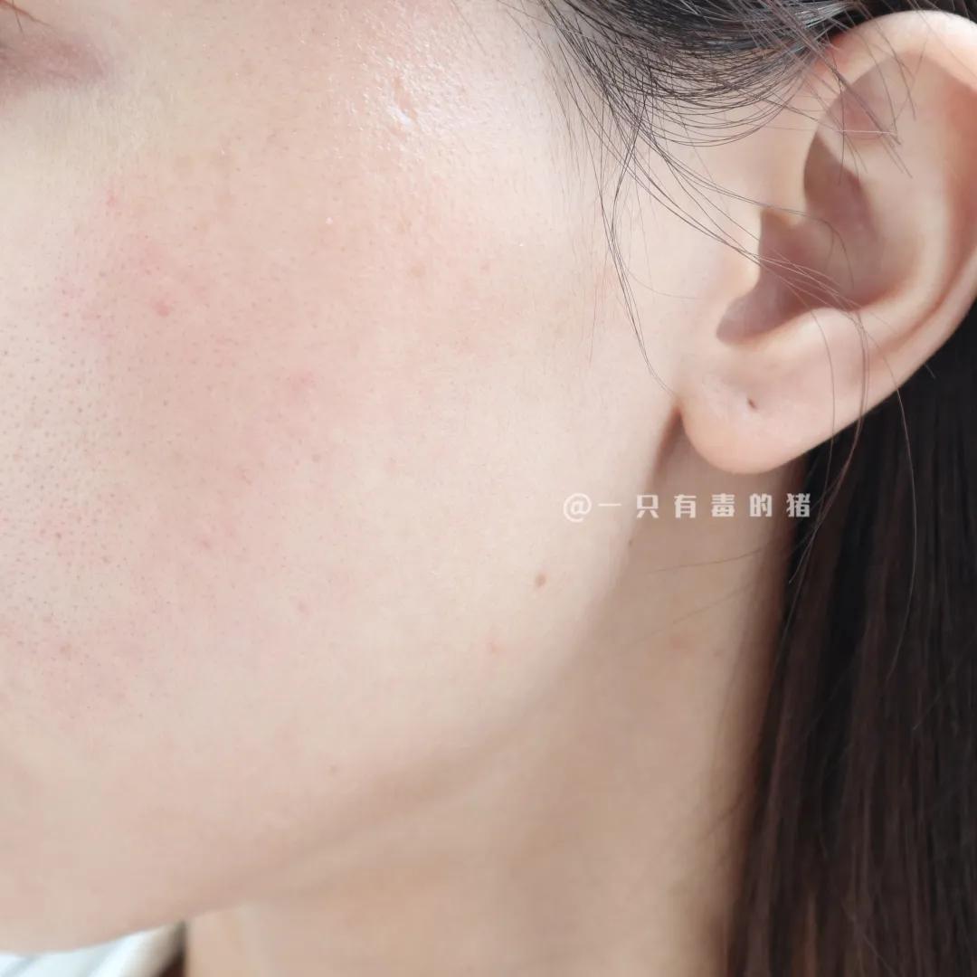 大油田收缩毛孔爽肤水,男士大油田爽肤水