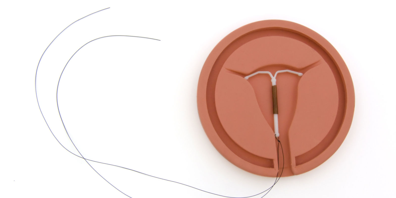 不打算再生娃哪种避孕方式更有效,常见的避孕方式有