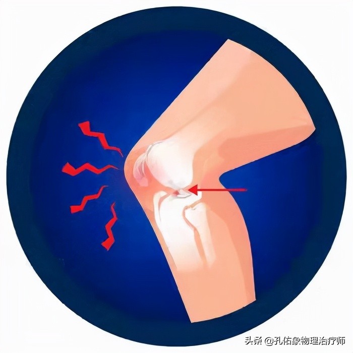 膝关节为什么疼,膝关节疼痛怎么治疗最好最有效