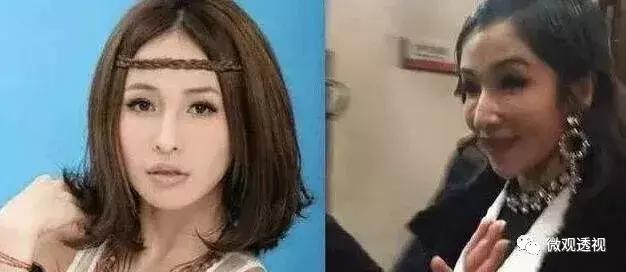 整容在韩国有多普遍,韩国整容贵还是国内整容贵