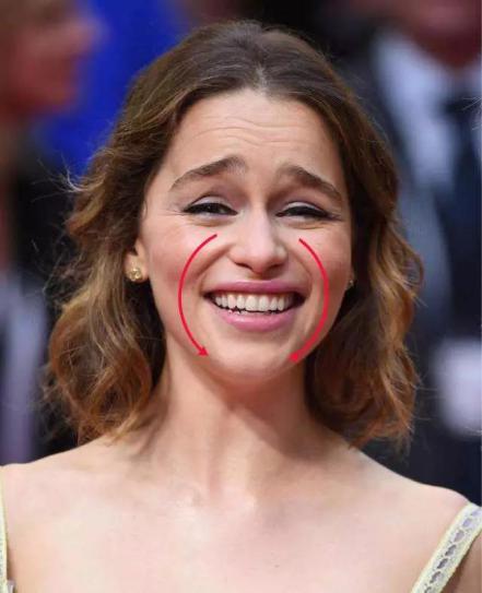 硬刚女皇龙妈也扛不住法令纹，2条沟壑让人心疼，贴一贴就消了