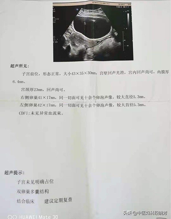 「看诊日常」一个月来两次月经,我是不是不太正常?