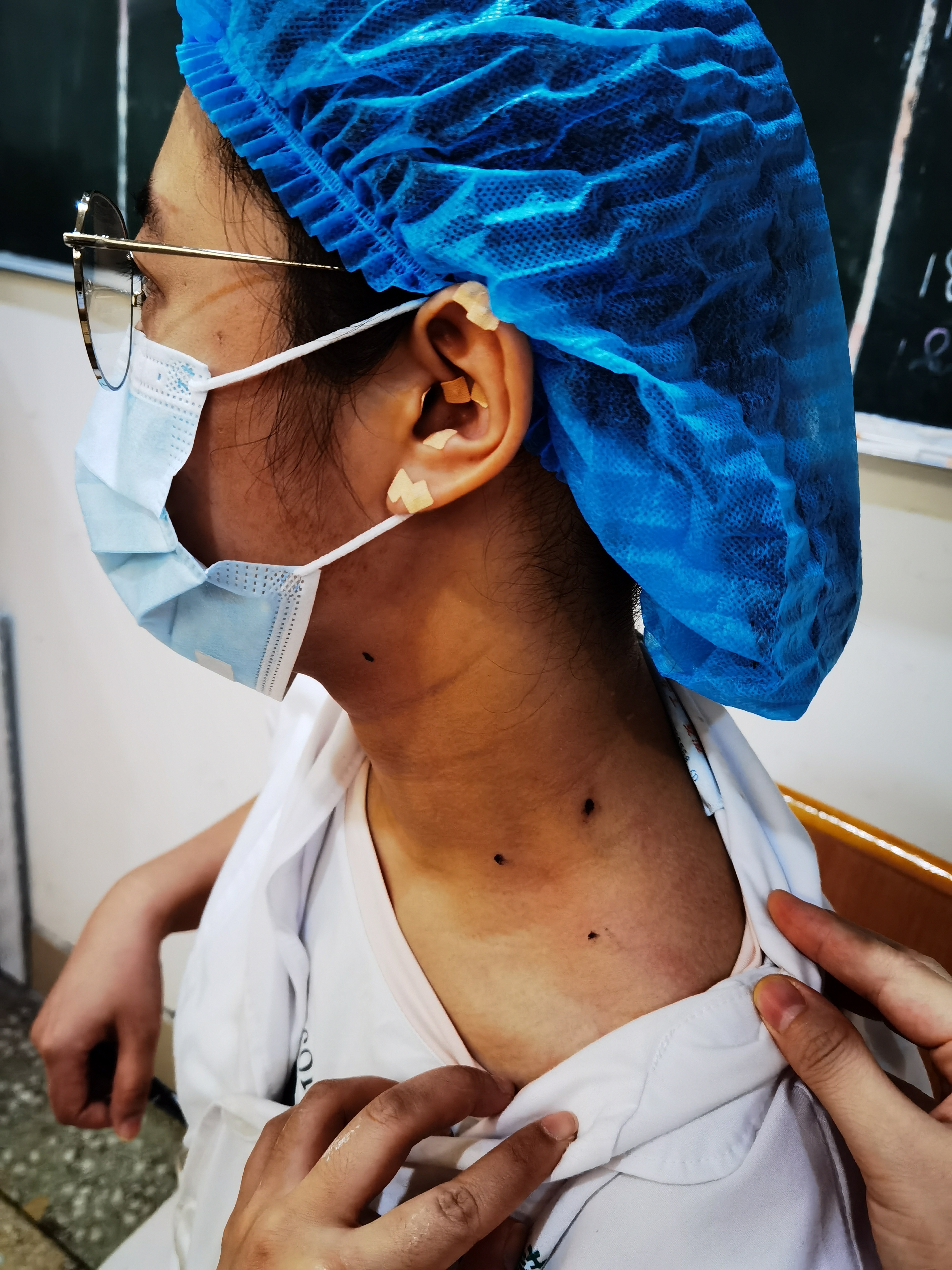 感冒失音,感冒失音怎么办