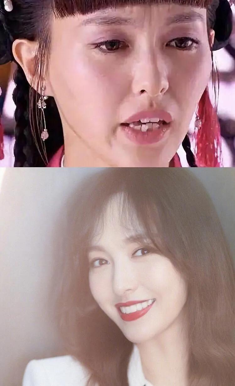 明星整牙前后对比,龅牙明星整牙前后的惊人变化