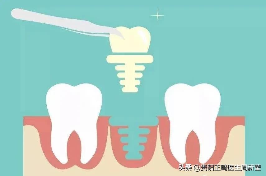 三天连续咬到嘴巴是馋了么,吃东西经常咬到肉是什么原因